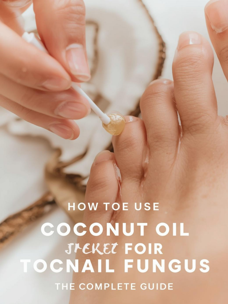 How to Use Coconut Oil to Treat Toenail Fungus: The Complete Guide